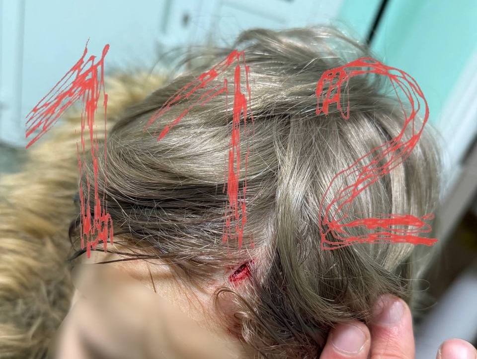 СК начал проверку после травмы ребенка в ресторане Ижевска