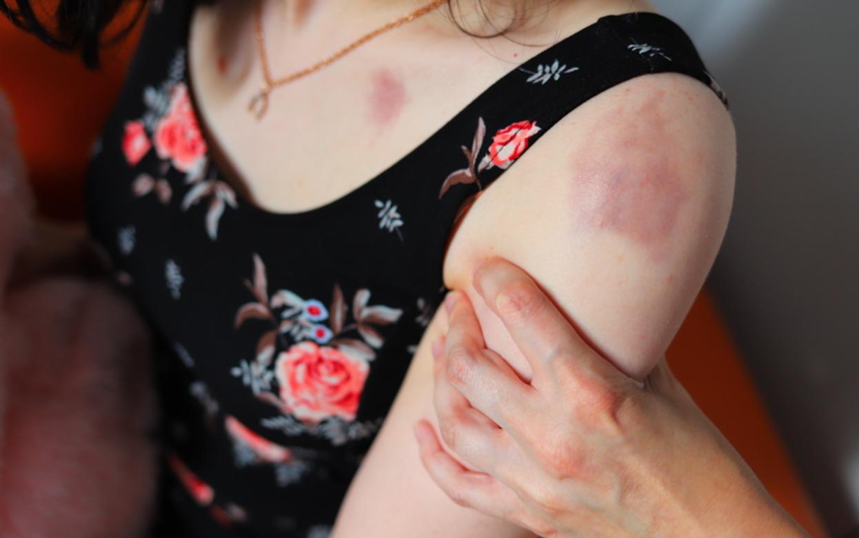 Жителя Удмуртии осудили за истязание малолетней дочери