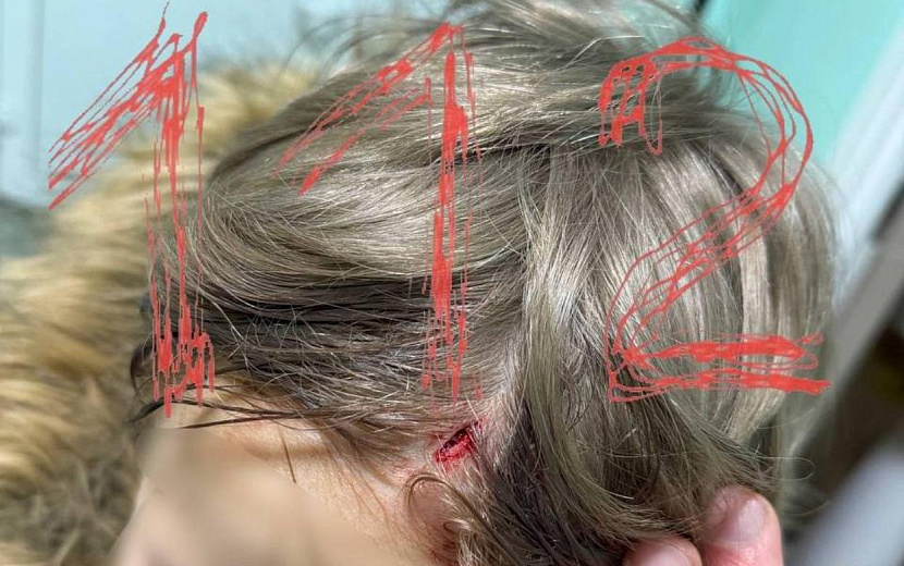 Фото: t.me/ENews112