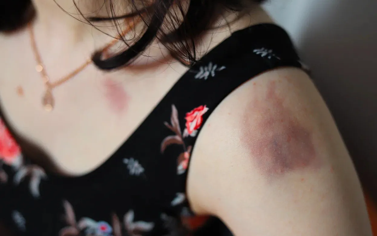 Топ-10 признаков псориаза: как вовремя распознать заболевание кожи