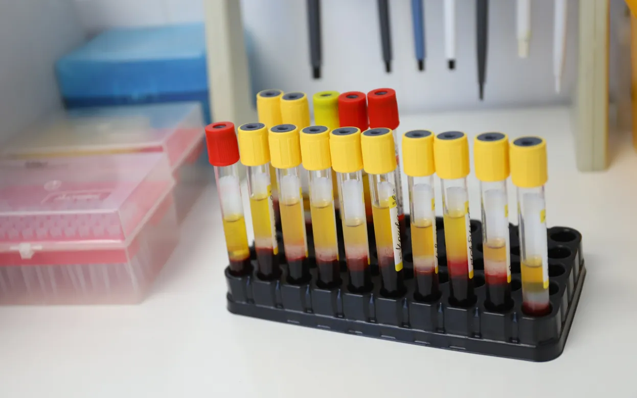 Опрос IZHLIFE: 35% ижевчан практически не проверяются на ВИЧ