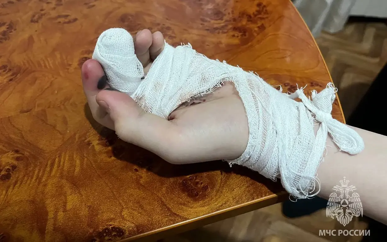 12-летний мальчик пострадал при взрыве петарды в Удмуртии