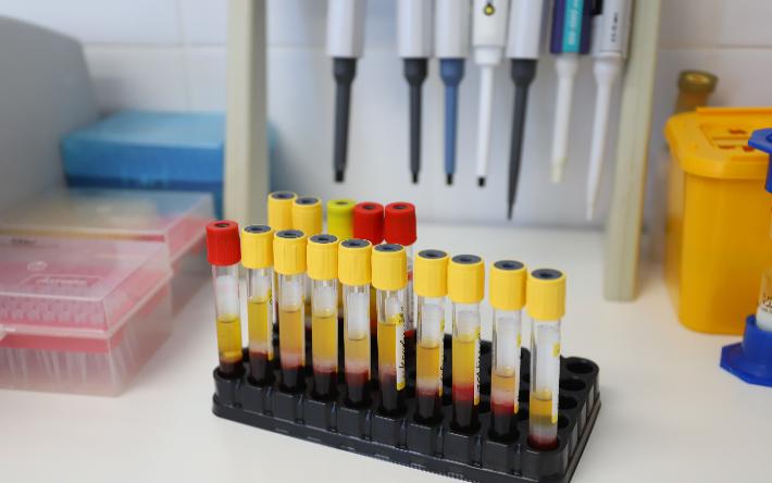 160 новых случаев коронавируса выявили в Удмуртии