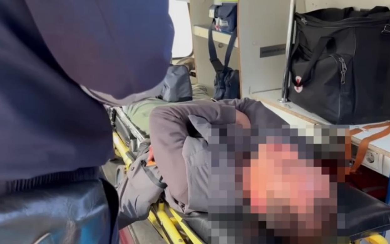 Пьяный мотоциклист пострадал в ДТП на ул. Клубной в Ижевске