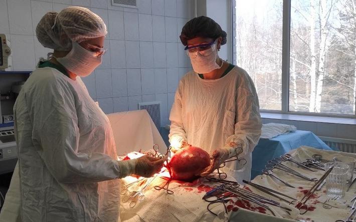 6-килограмовую миому удалили врачи у женщины в Ижевске