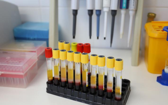 27 новых случаев коронавируса выявили в Удмуртии
