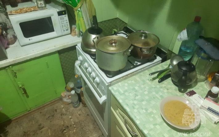 Пенсионерка получила серьезные ожоги при приготовлении еды в Ижевске