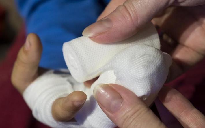 Одного из пострадавших от детонации снаряда в Удмуртии детей госпитализировали