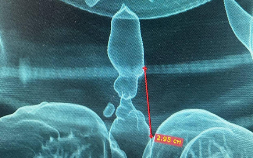 Фото: пресс-служба Минздрава Удмуртии