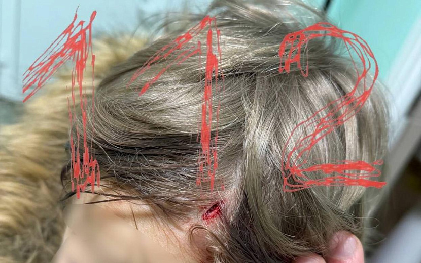 Фото: t.me/ENews112