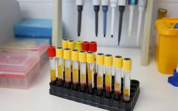 9 ковид-пациентов госпитализировали в Удмуртии за сутки