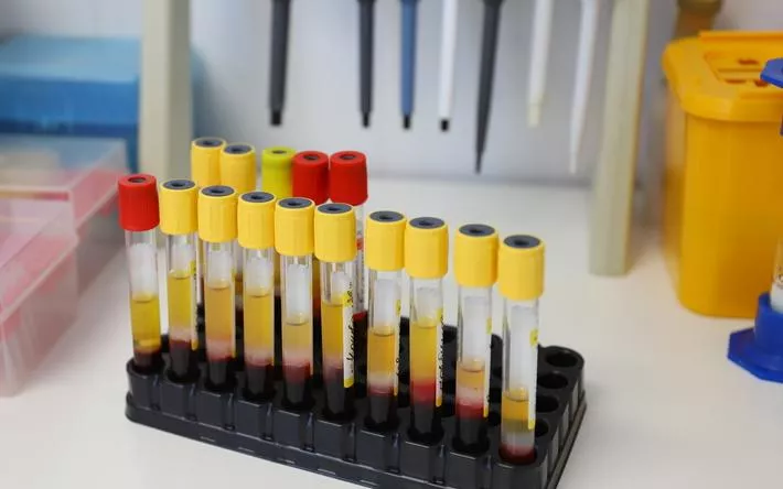 Более 60 больных гепатитом С детей обеспечат лекарствами в Удмуртии