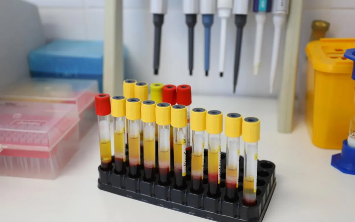 Свыше 470 новых случаев ВИЧ выявили в Удмуртии в 2025 году