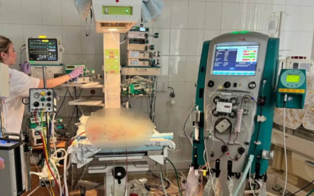 Врачи в Удмуртии спасли 4-летнего ребенка с критическим септическим шоком