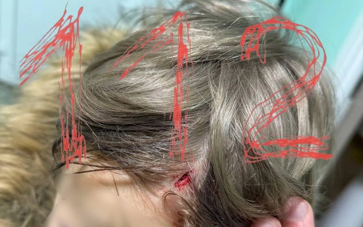 Ребенок разбил голову в одном из ресторанов Ижевска