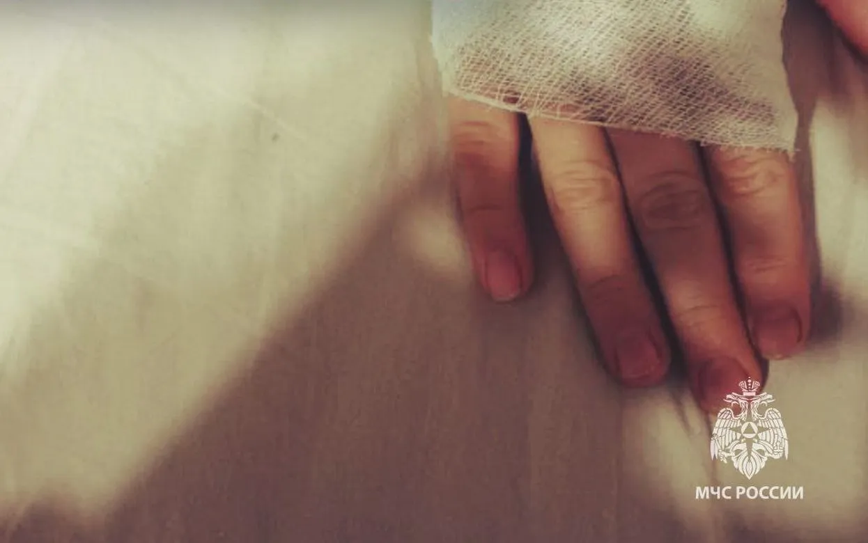 10-летний мальчик получил ожоги после взрыва петарды в Удмуртии