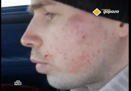 Нападение на водителя в Ижевске: пострадавший написал заявление в полицию