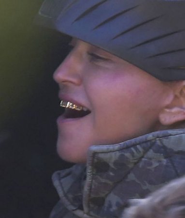 Мадонна сделала себе золотые зубы