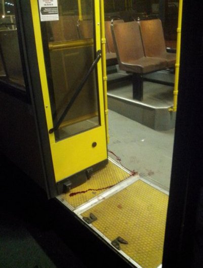 Пассажирка, пострадавшая в ижевском автобусе №8: «Крови было столько, что хоть одежду выжимай»