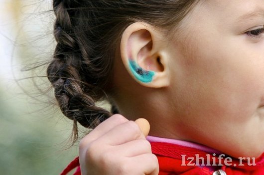 Пострадавшая от пульки на набережной Ижевска девочка пока не ходит в детсад