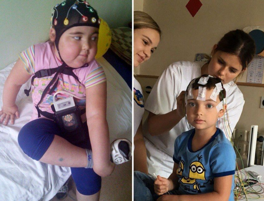 Слева – Аня в начале лечения, после гормональных препаратов, справа – Аня во время процедуры в Германии, в 2016 году.